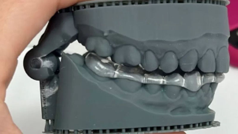 Genee Splint Gnathologist and Splint therapy - Vilnius, Lithuania